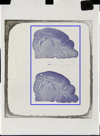 Media type: image; Special Collections 3043   shows specimen_part histological serial section;